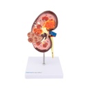 3-21513-01-heinescientific-modell-niere-mit-zysten.jpg
