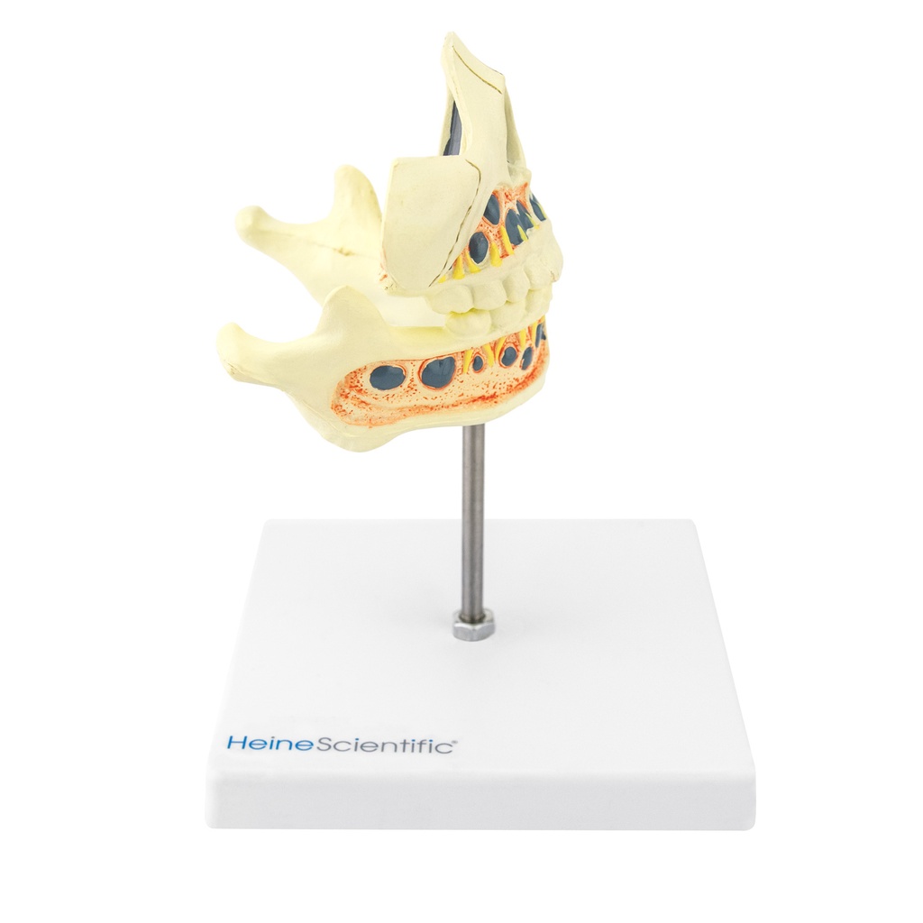 2-21493-01-heinescientific-milchzahngebiss.jpg