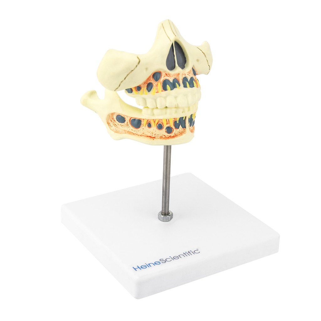 4-21493-01-heinescientific-milchzahngebiss.jpg