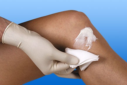 NOBA MK Gauze swabs 16 ply non-sterile