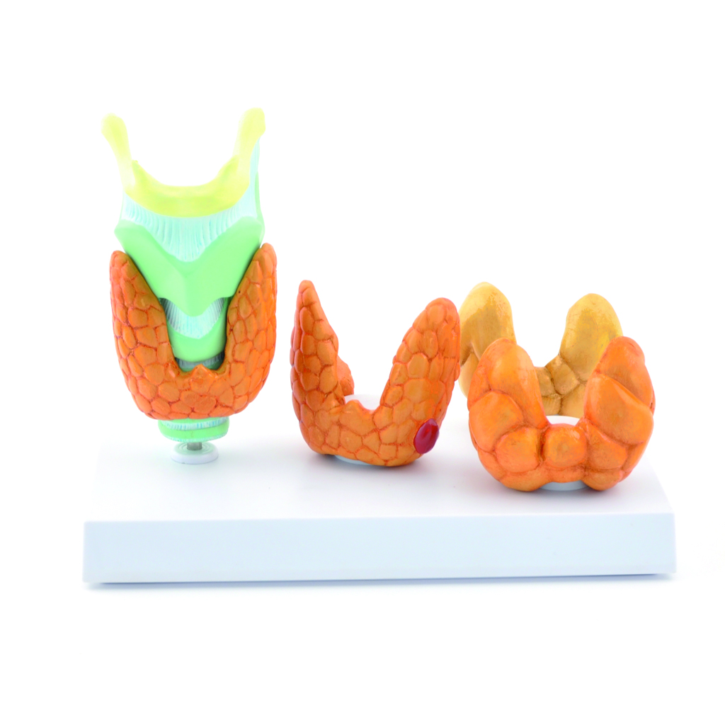 HEINESCIENTIFIC Anatomisches Modell der Schilddrüsenerkrankungen