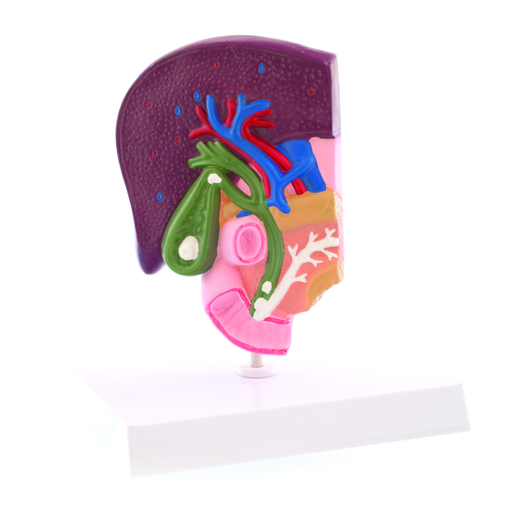 HEINESCIENTIFIC Anatomisches Modell der Gallenblase mit ihren Erkrankungen
