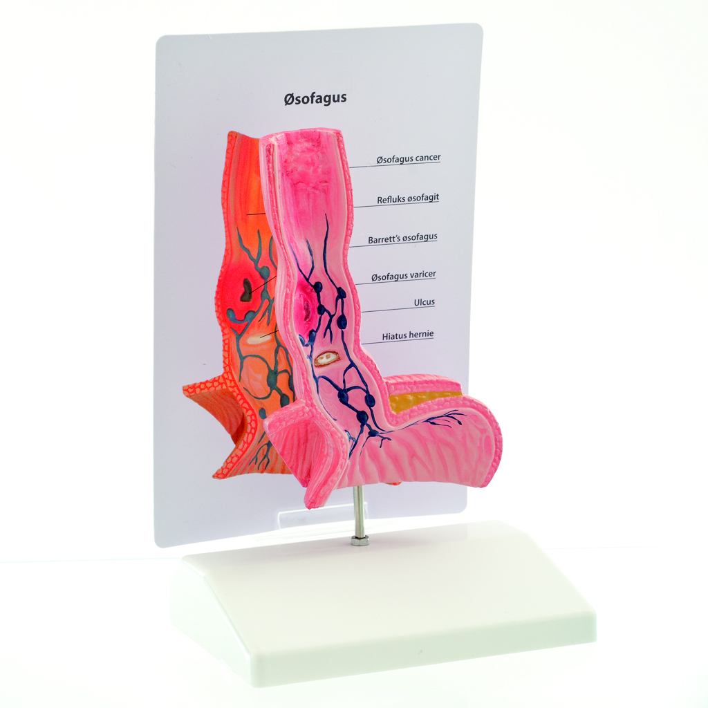 HEINESCIENTIFIC Anatomical model of a human esophagus