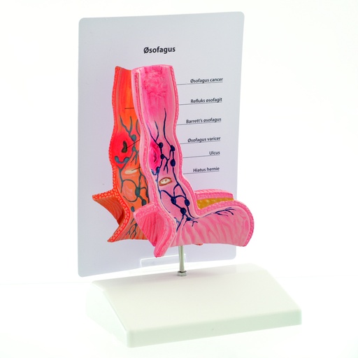 [14735-01] HEINESCIENTIFIC Anatomisches Modell einer menschlichen Speiseröhre