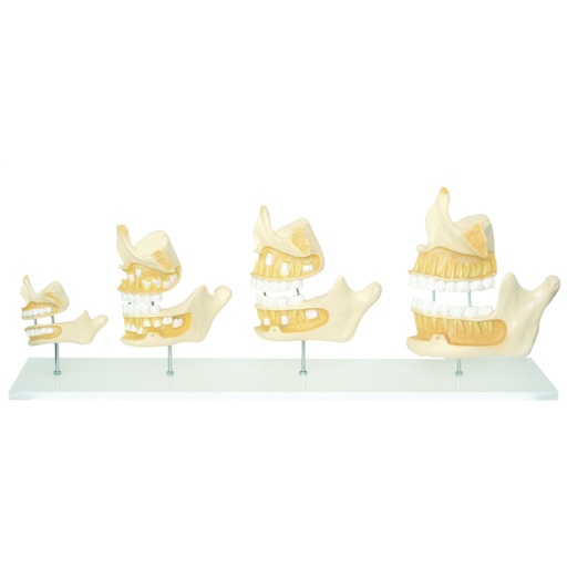 [14736-01] HEINESCIENTIFIC Anatomical model of human dentition development