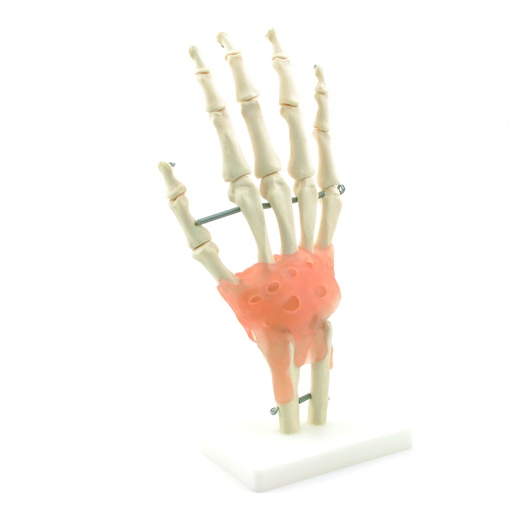 [14751-01] HEINESCIENTIFIC Hand-Skelettmodell mit Bandapparat