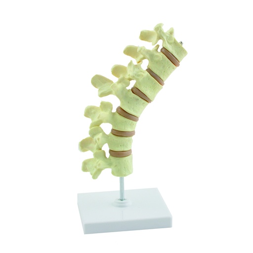 [14768-01] HEINESCIENTIFIC Osteoporosis model spine