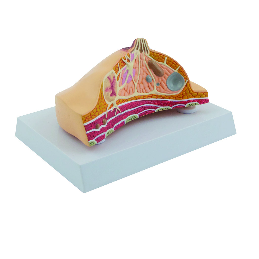 HEINESCIENTIFIC Breast model with typical diseases