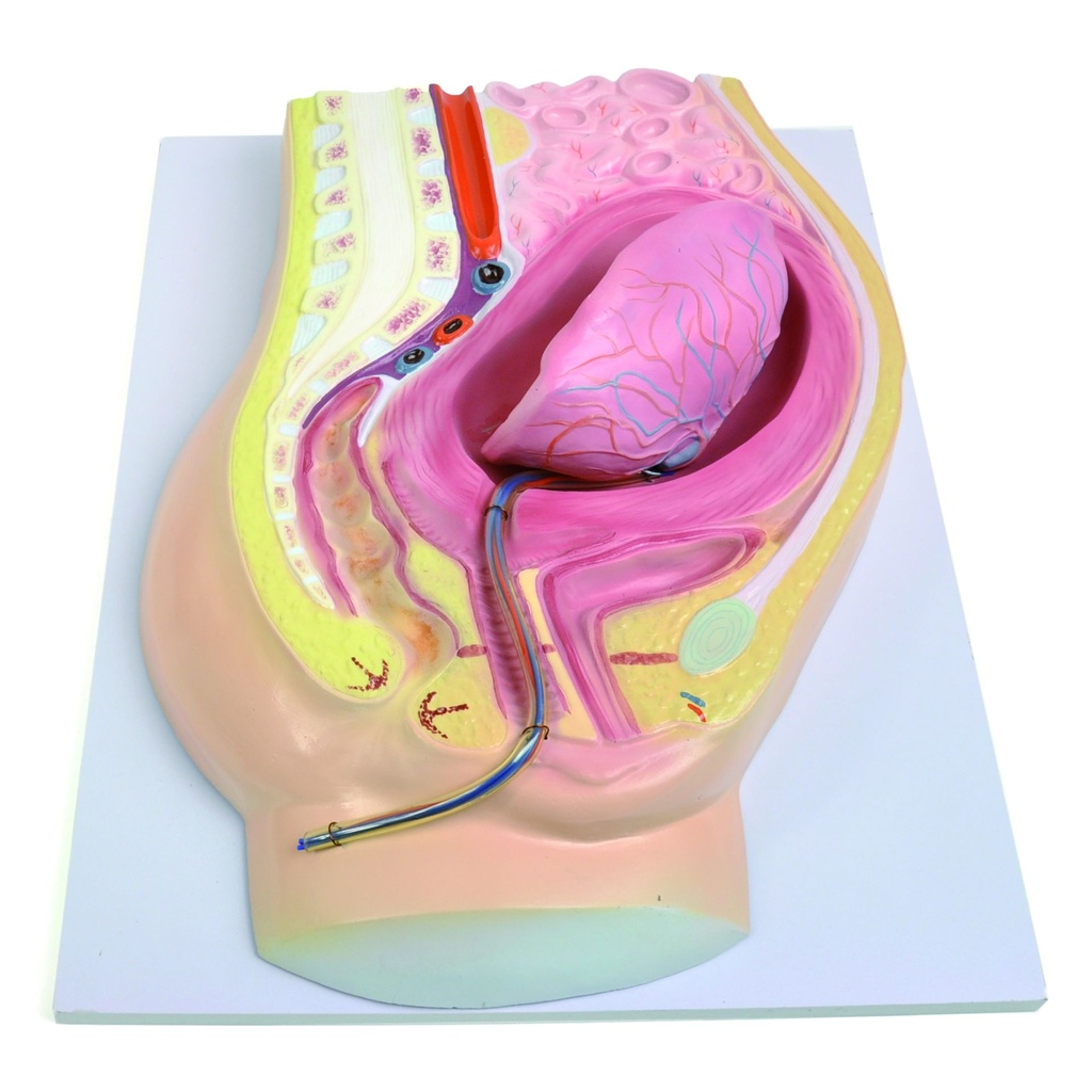 HEINESCIENTIFIC Model of placental abruption