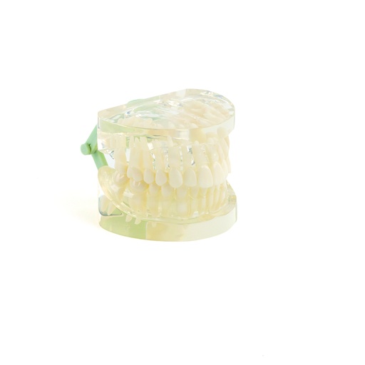 [14795-01] HEINESCIENTIFIC Transparent jaw model Adult dentition