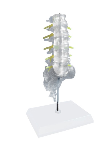 [14801-01] HEINESCIENTIFIC Modell der Lendenwirbelsäule in Lebensgröße transparent