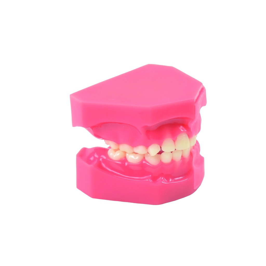 HEINESCIENTIFIC Model of tooth development, comparison 5/9 years