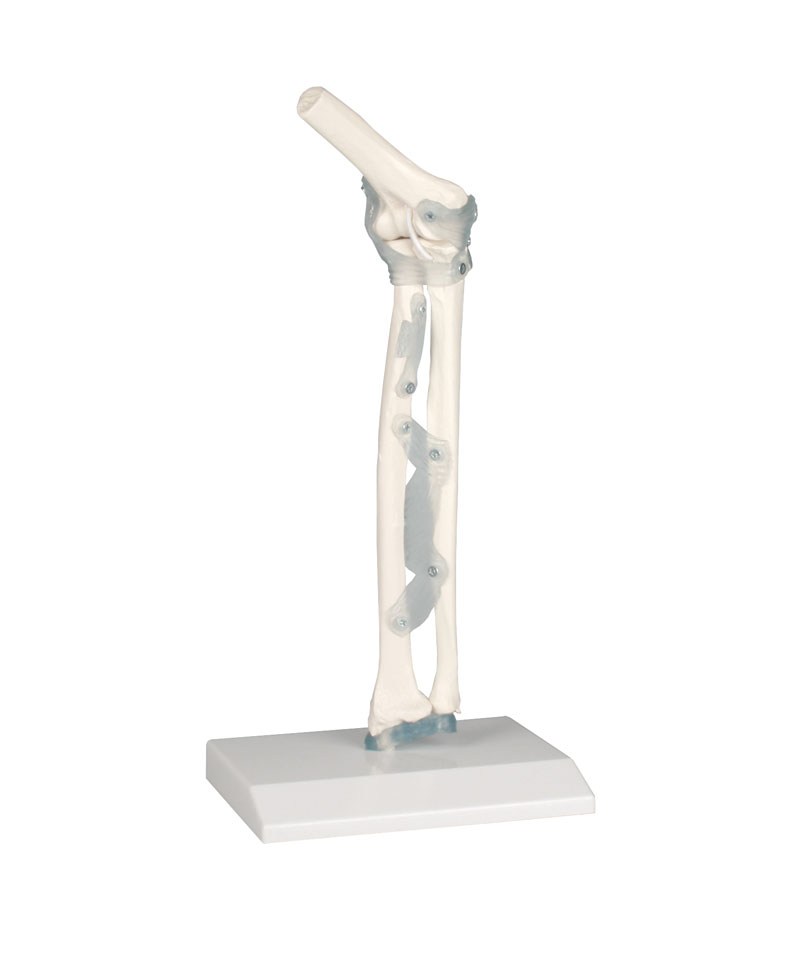 ERLERZIMMER Elbow Joint with Ligaments and Stand