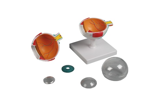 [21027-01] ERLERZIMMER Eye Model 4-times size 6-part