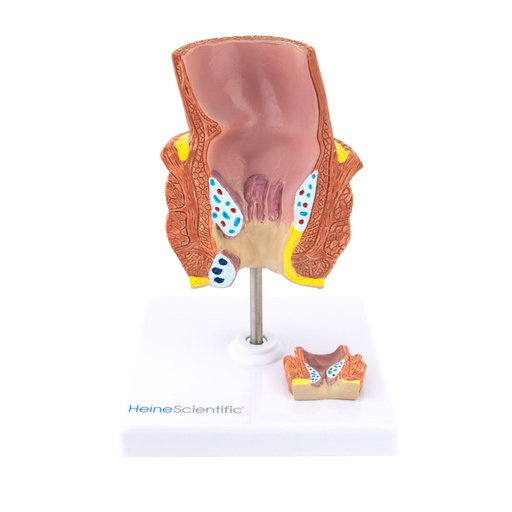 [21505-01] HEINESCIENTIFIC Hemorrhoid model