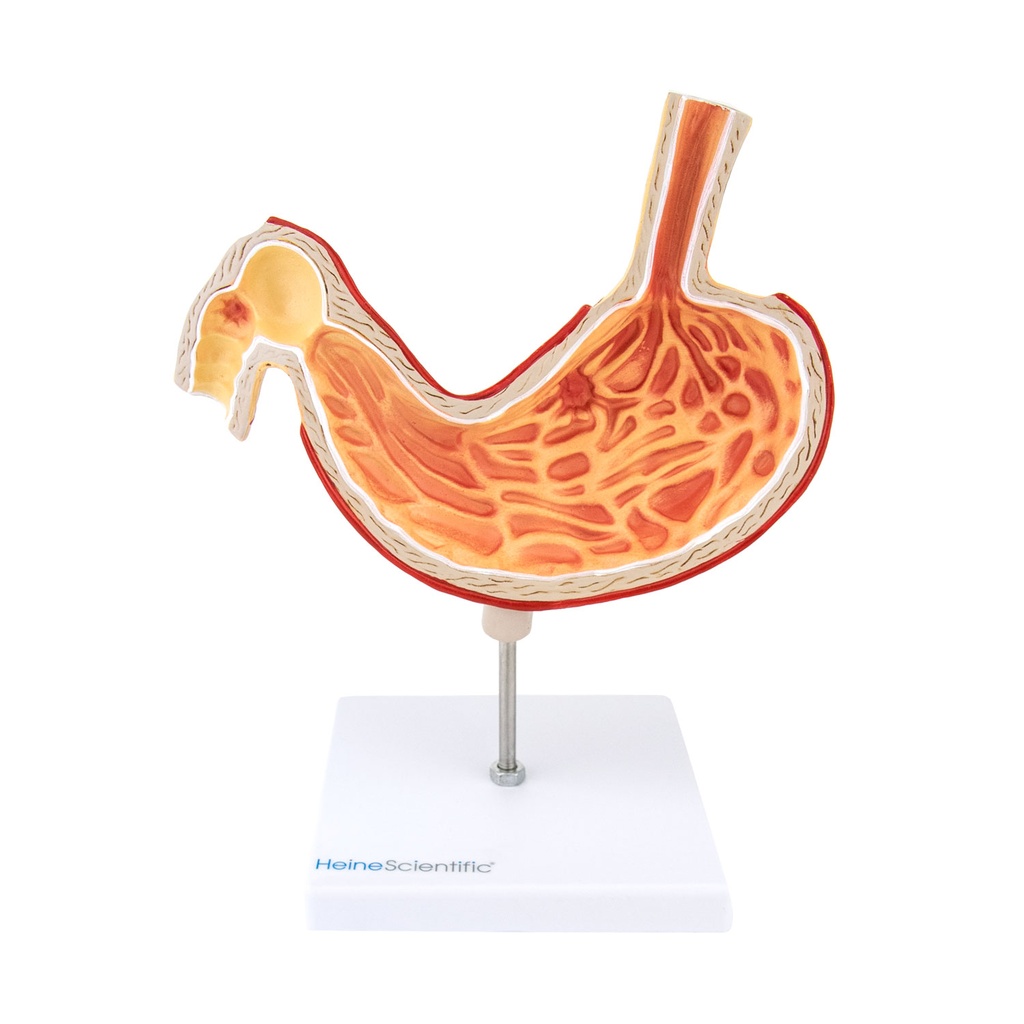 HEINESCIENTIFIC Model of a stomach with ulcers
