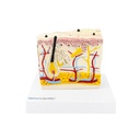 HEINESCIENTIFIC Hautmodell mit Psoriasis