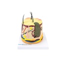 HEINESCIENTIFIC Hautmodell mit Akne