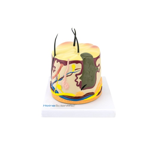 [21510-01] HEINESCIENTIFIC Skin model with acne