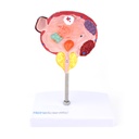 HEINESCIENTIFIC Modell der männlichen Blase und Prostata mit Erkrankungen