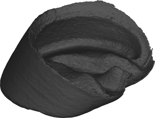 [22658-01] ERLERZIMMER Hoof Capsule