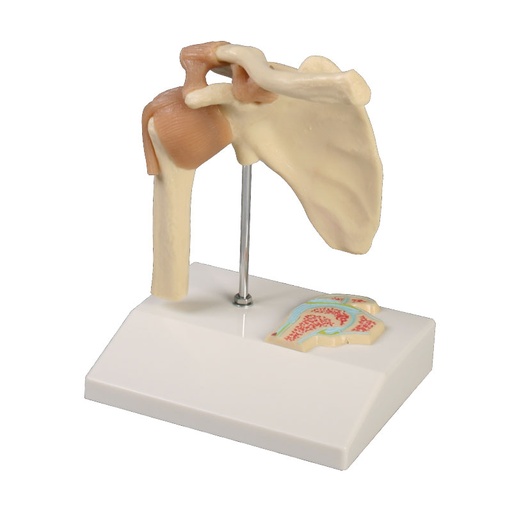[23158-01] ERLERZIMMER Mini Shoulder Joint Model with Cross Section