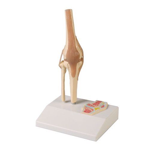 [23159-01] ERLERZIMMER Mini Knee Joint Model with Cross Section