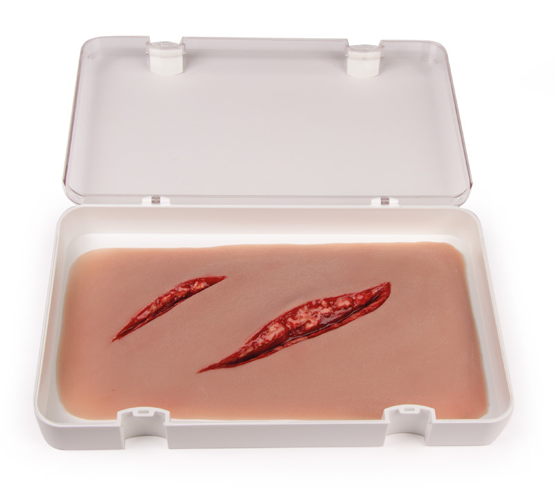 ERLERZIMMER Cut Wound large with Bleeding Function