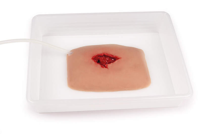 ERLERZIMMER Wound Moulage Wound Packing