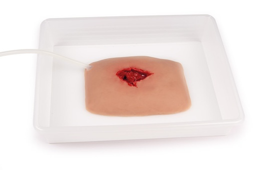 [23479-01] ERLERZIMMER Wound Moulage Wound Packing
