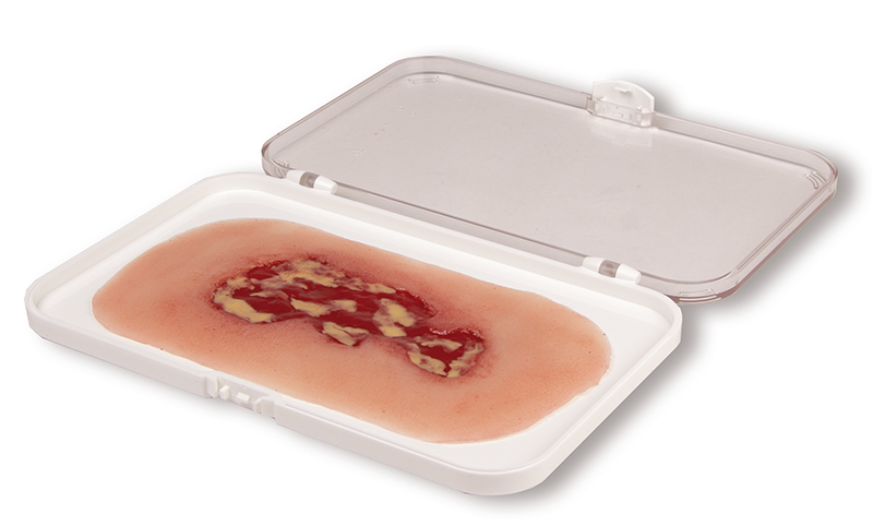 ERLERZIMMER Wound Moulage Venous Leg Ulcer small Exudation Phase