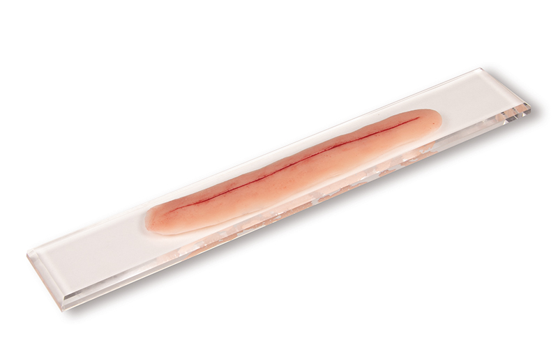 ERLERZIMMER Surgical Wound, without suture 22 cm for self-suturing