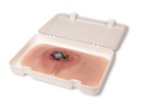 ERLERZIMMER Wound Moulage Sacral Decubitus untreated