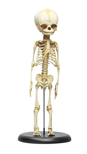 [24539-01] ERLEZIMMER Fetal Skeleton 30th week