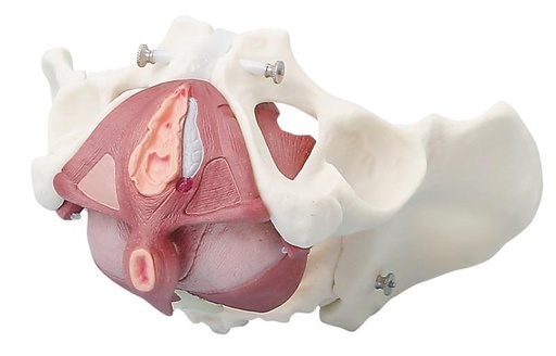 [24542-01] ERLERZIMMER Pelvis Model