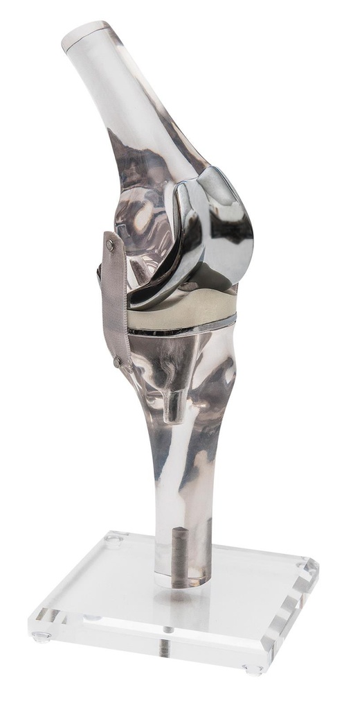 ERLERZIMMER Kniemodell mit Endoprothese