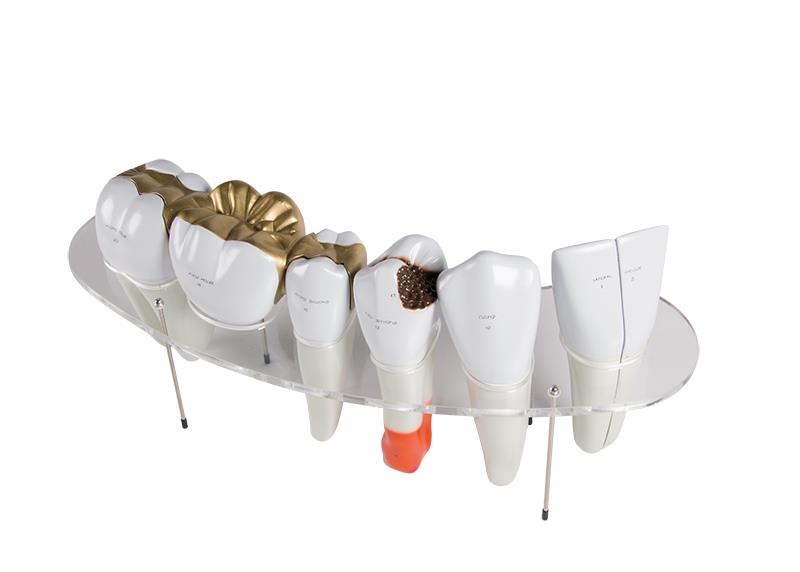ERLERZIMMER Denture Model, 7-part, 10-times size