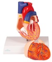 ERLERZIMMER Heart Model, 2-part with Conduction System