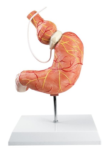 [24583-01] ERLERZIMMER Stomach Model with Gastric Band