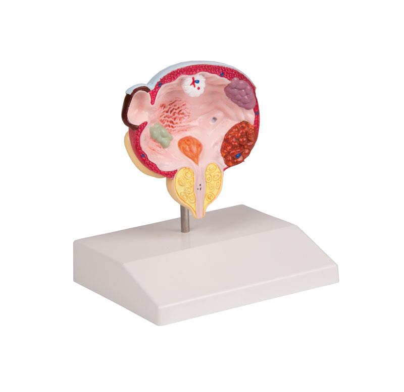 ERLERZIMMER Erkrankungen von Blase und Prostata