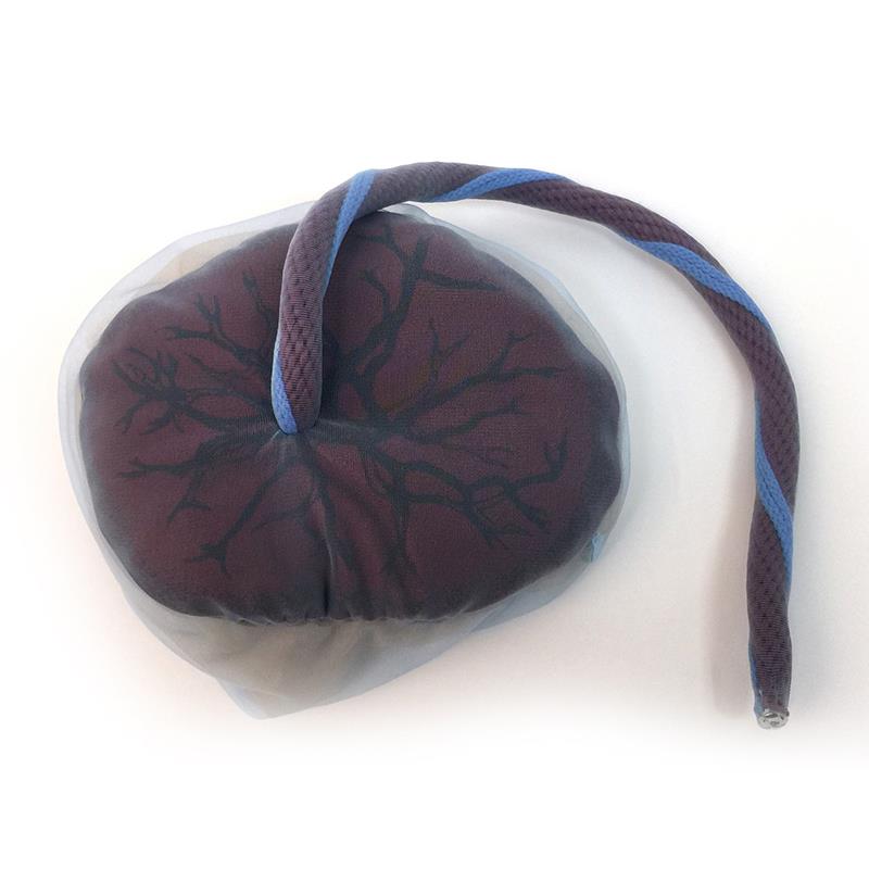 ERLERZIMMER Placenta and Umbilical Cord