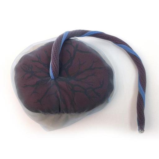 [24588-01] ERLERZIMMER Placenta and Umbilical Cord