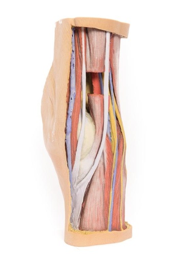 [24597-01] ERLERZIMMER Popliteal fossa