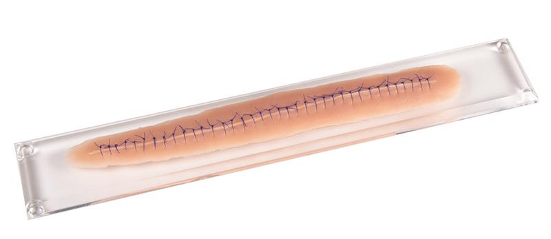ERLERZIMMER Surgical Wound, with suture, 22cm