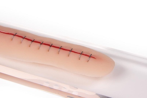 [24635-01] ERLERZIMMER Surgical Wound, stapled, 22cm