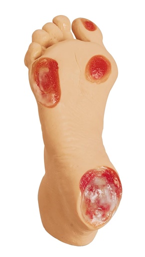 [24638-01] ERLERZIMMER Geriatric Pressure Ulcer Foot