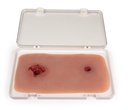 ERLERZIMMER Gunshot Wound Leg with Bleeding Function
