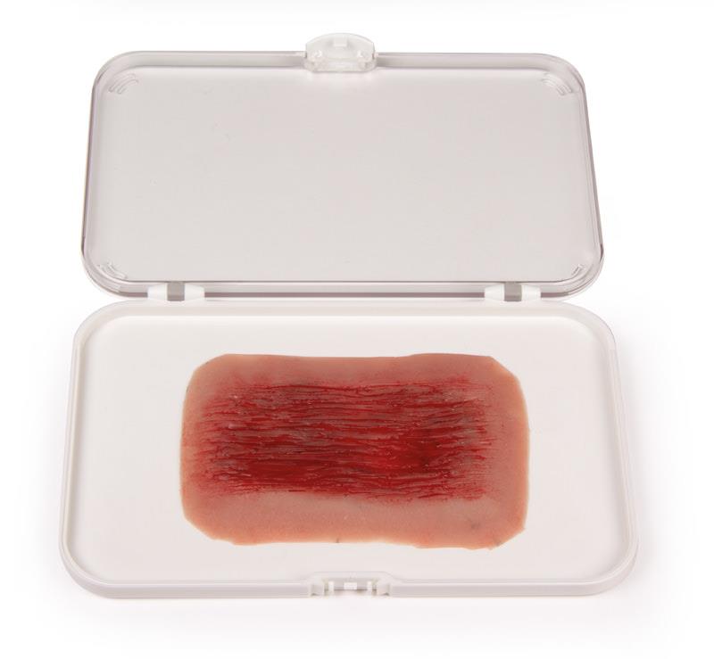 ERLERZIMMER Wound Moulage Abrasion