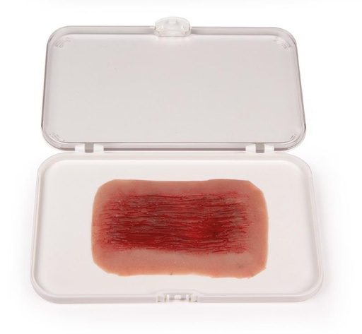 [24685-01] ERLERZIMMER Wound Moulage Abrasion