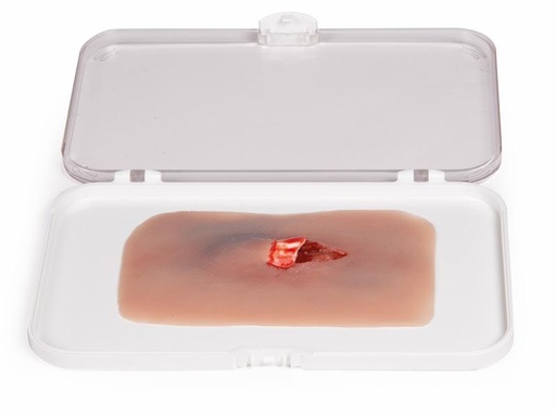 [24687-01] ERLERZIMMER Wound Moulage Open Bone Fracture